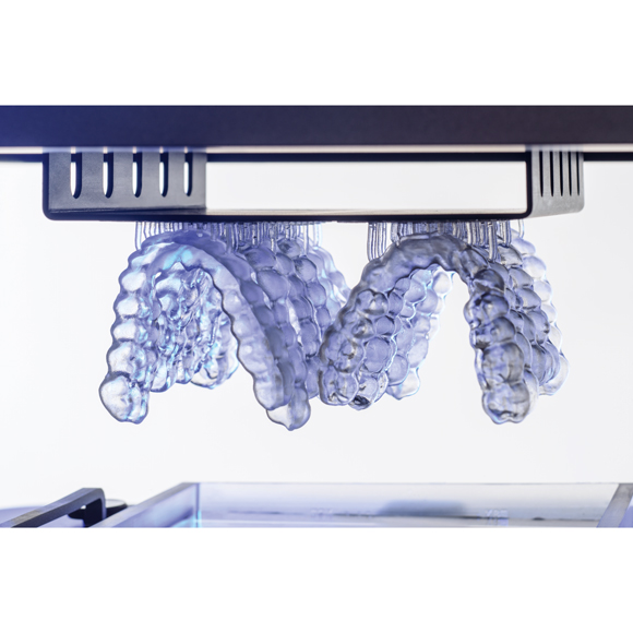 Splints made with the VOCO SolFlex 350 3D printer